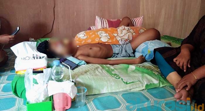 Mengeluh Kaki Kram, Mustofa Idap Kanker Tulang Ganas, Butuh Uluran Tangan untuk Berobat